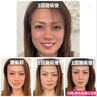 本気で顔悩み改善するなら回数券が正解