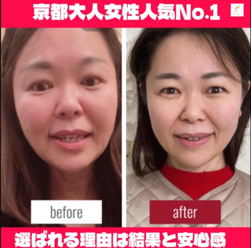 セルフケア動画 × サロン施術＝最速で小顔に近づく方法