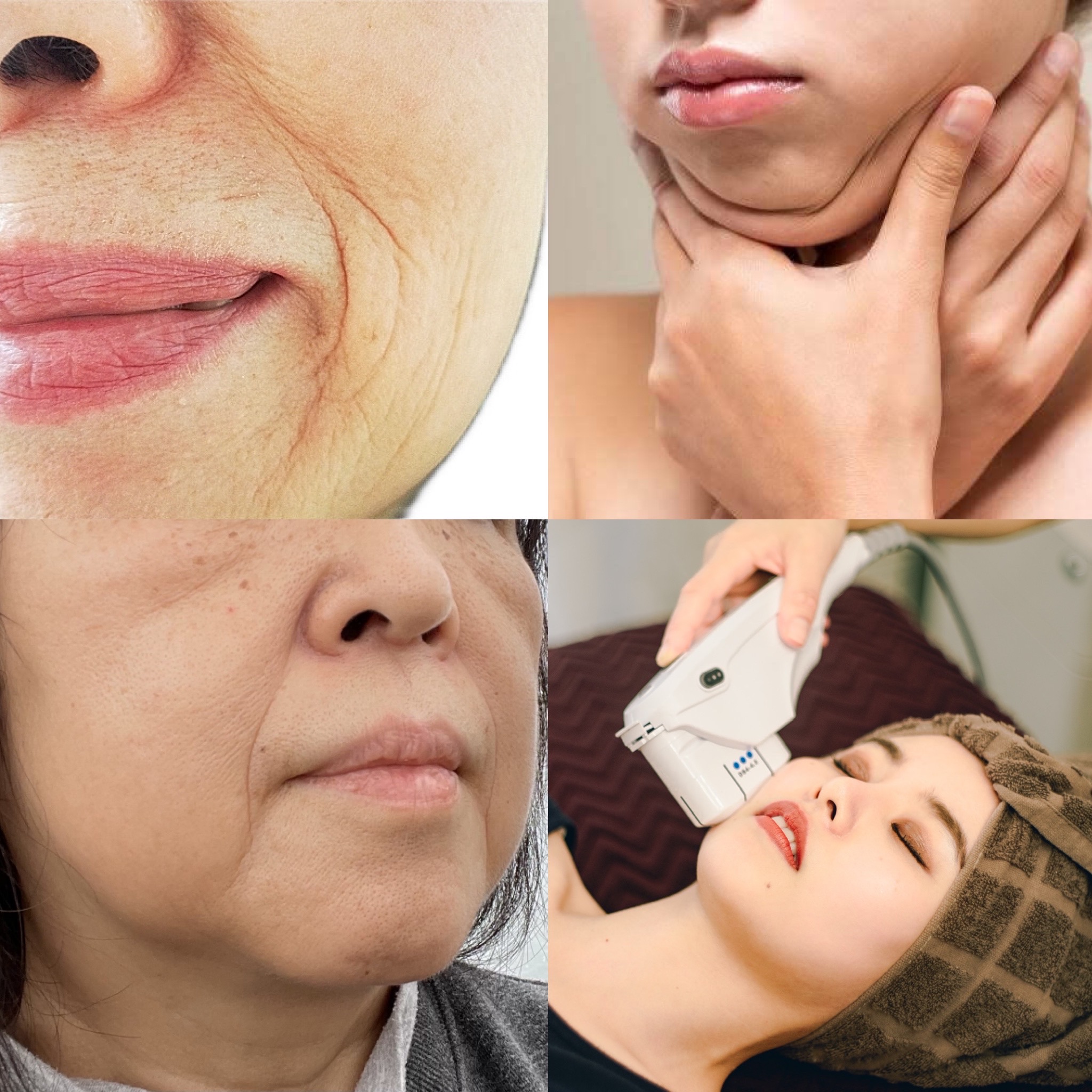 【40代以上肌悩み】歪みによって引き起こされています