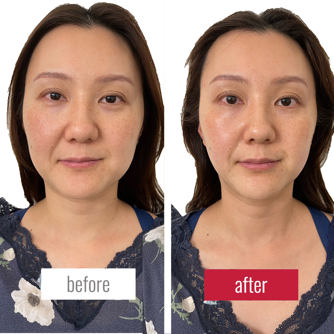 施術実感度が高い理由を教えます！サロンチオリver.