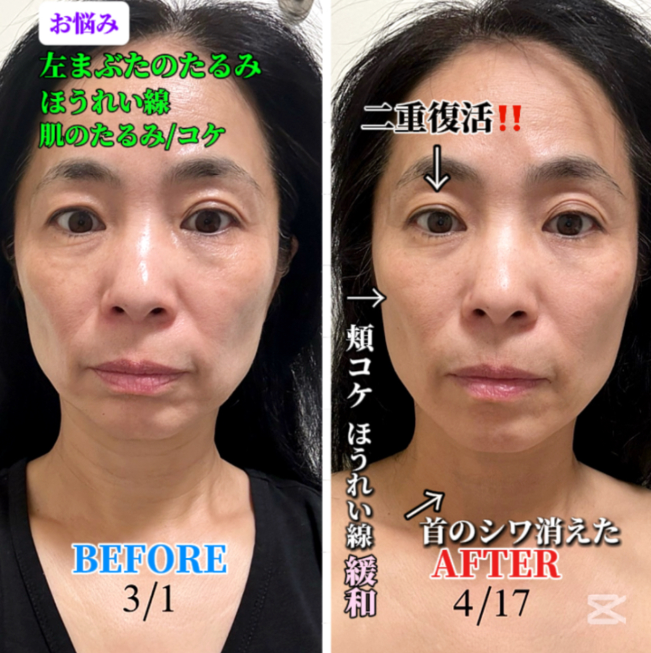 【人気の秘密】 40代!50代!60代に大人気の理由教えます
