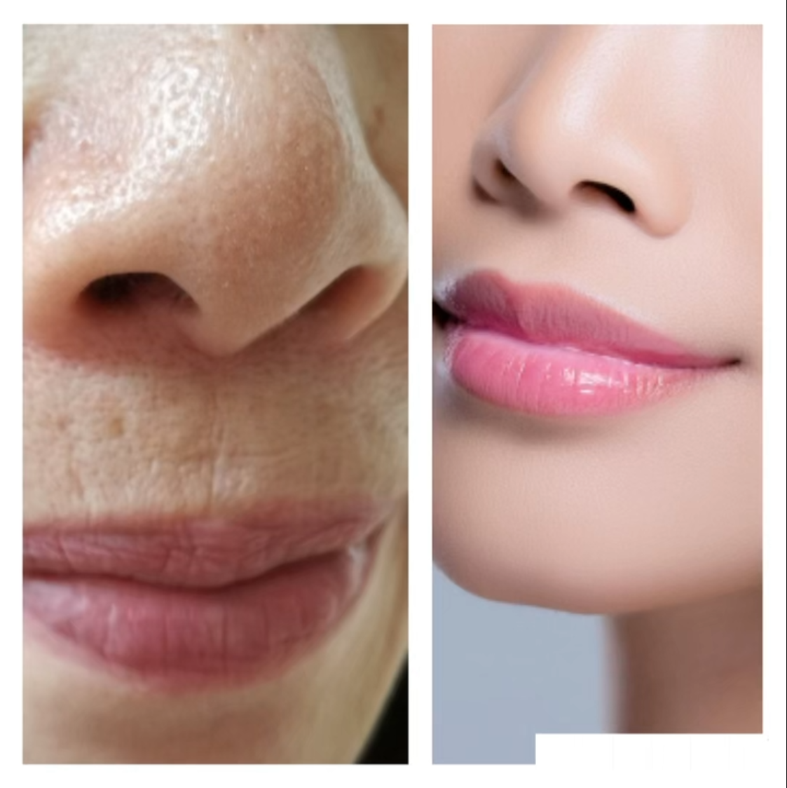 【老化予防】に小顔矯正が効果的な理由!!