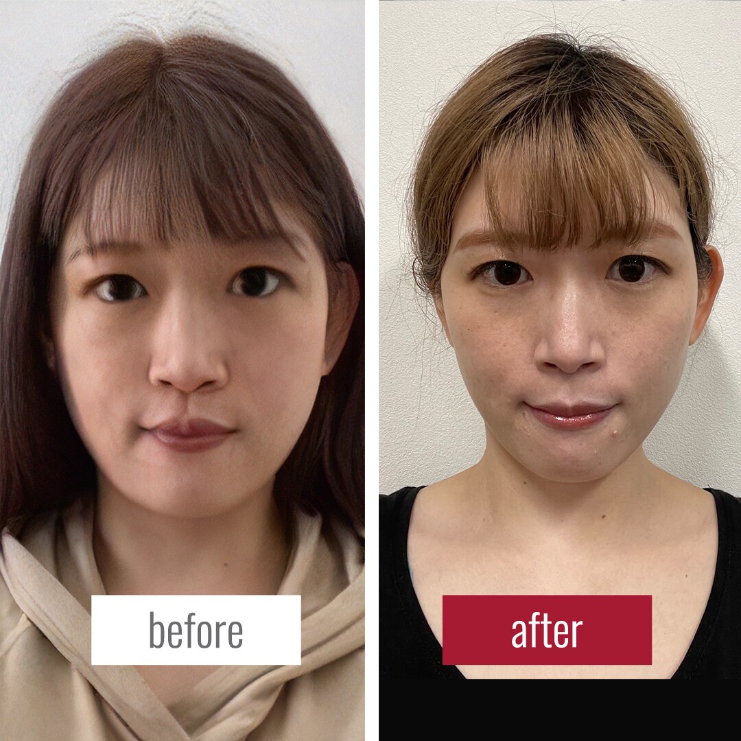 《お客様登場2☆》コレやるとこのぐらい顔、変わる！