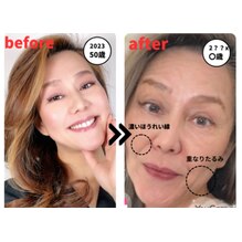 《知ってた?》頭の骨が老化で縮むってこと!!