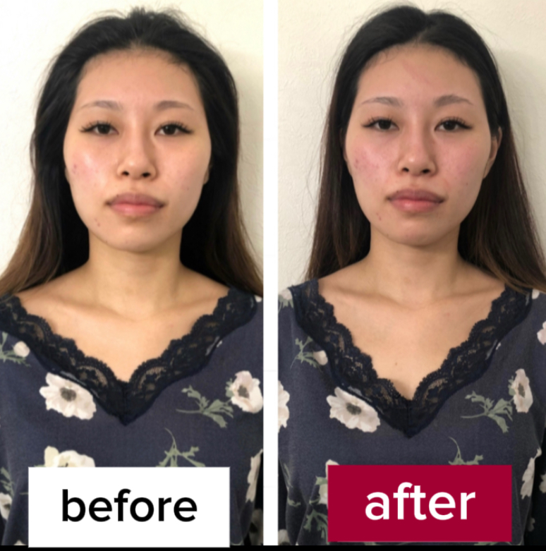 《お客様登場5☆》コレやるとこのぐらい顔、変わる！