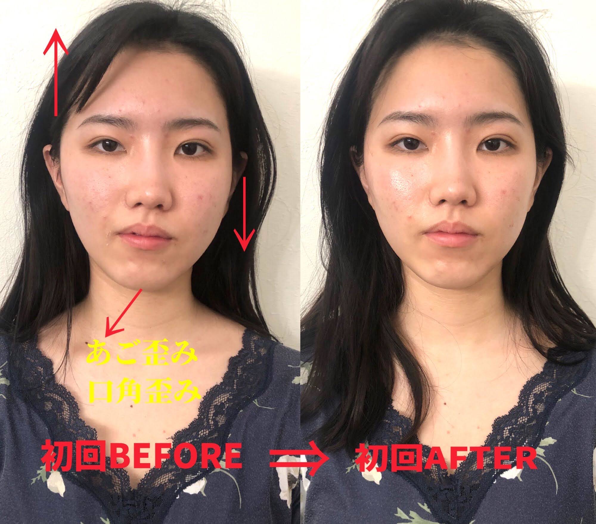 《お客様登場6☆》コレやるとこのぐらい顔、変わる！