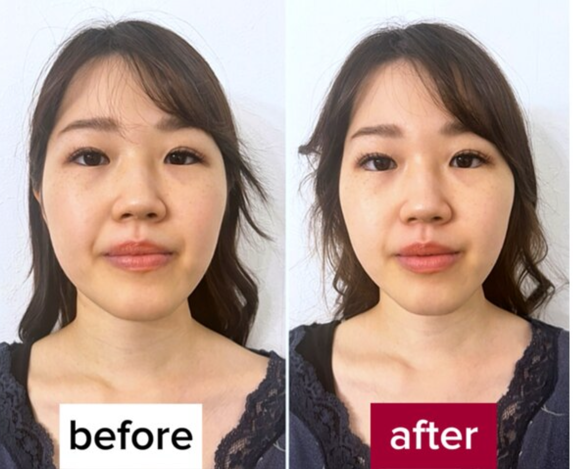 【2025年最新メニューの選び方】サロンチオリ編