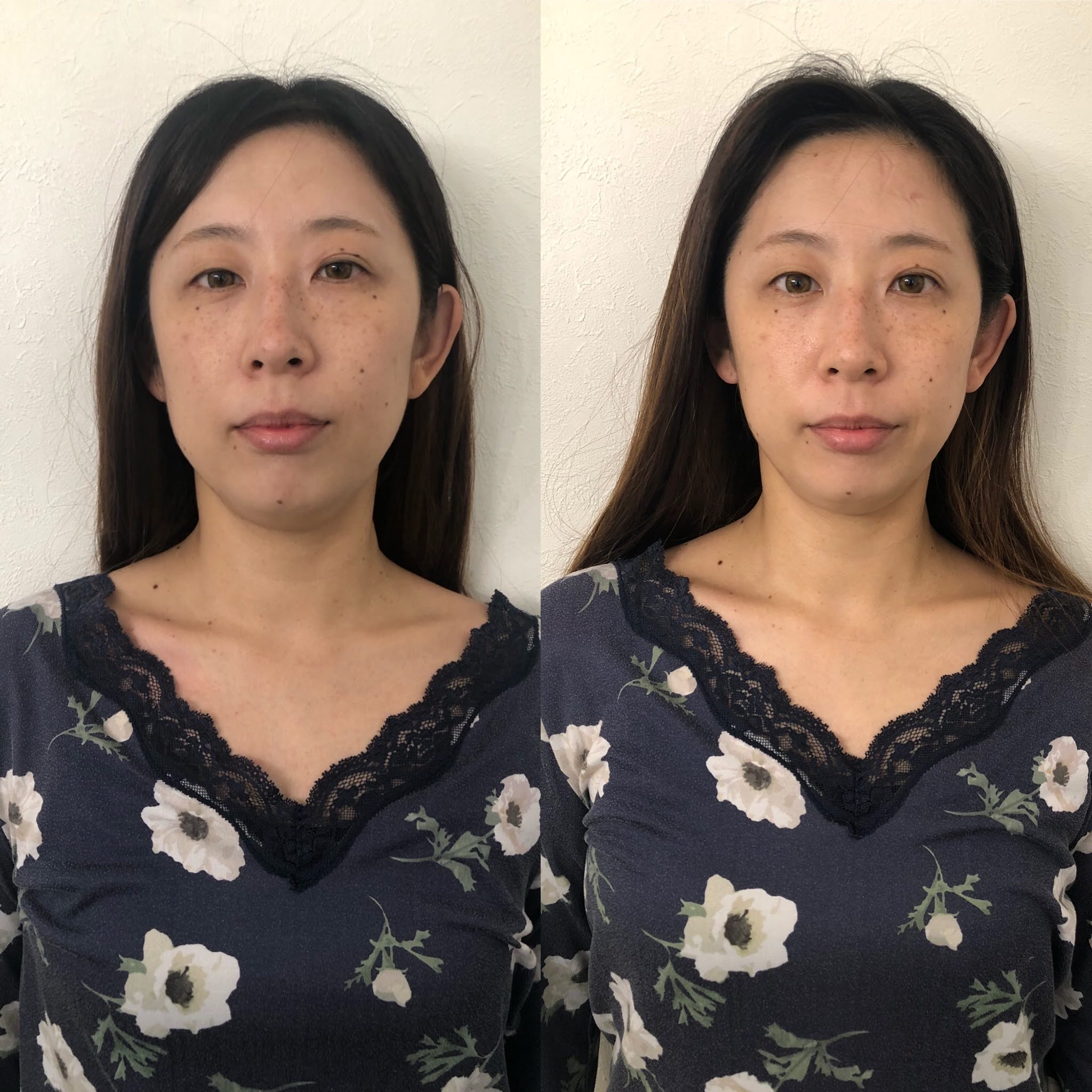 【有資格者】私がサロンチオリを選んだ理由です