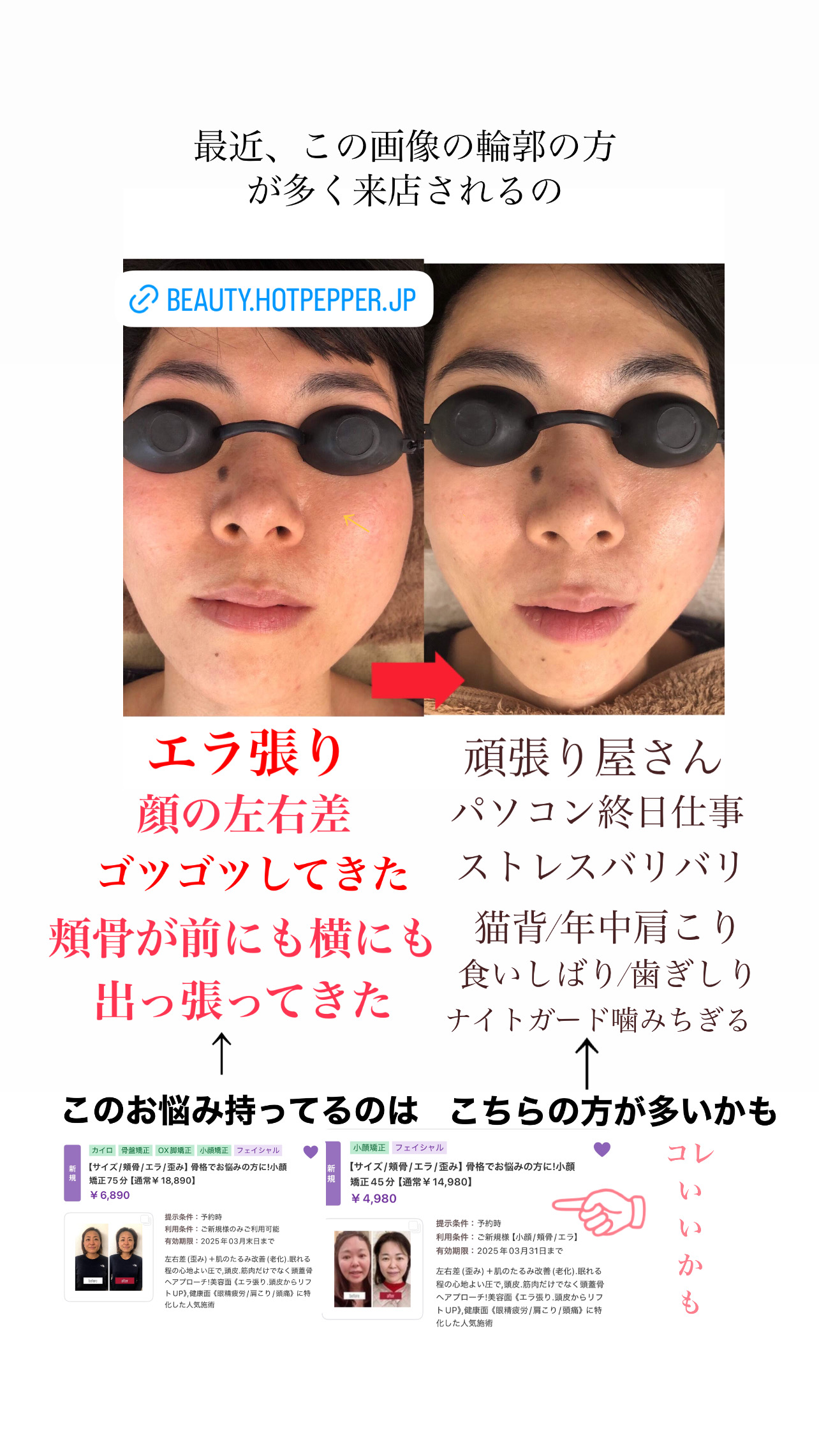 ＜お客様登場6★＞ コレやるとこのぐらい顔、変わる！ 初