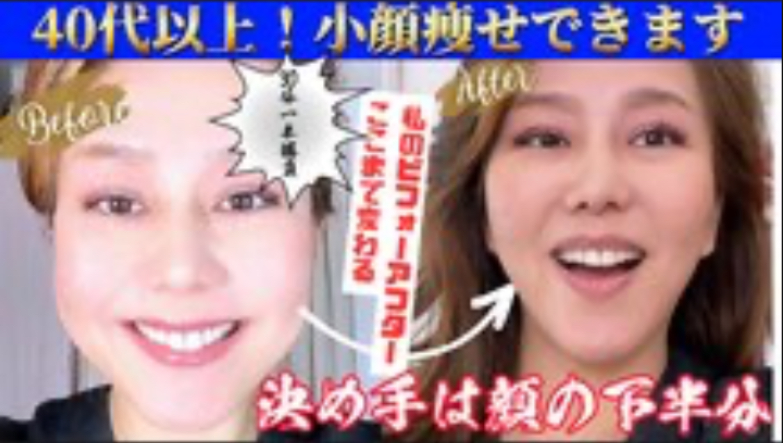 長年の顔の悩みがちおり式小顔矯正で改善するのはなぜ