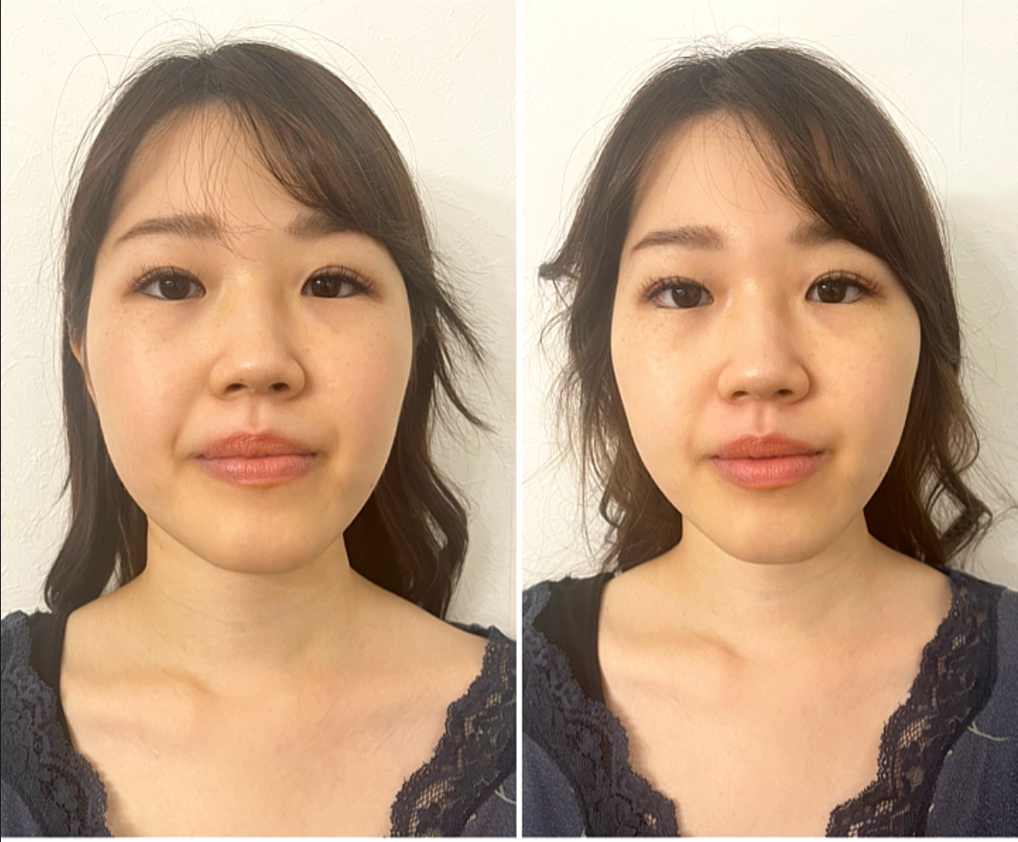 美顔マッサージ施術で<顔のゆがみ>は改善しません!