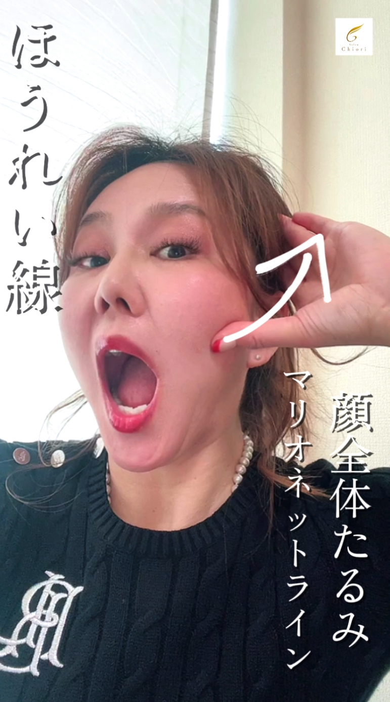 ちおり式小顔矯正が唯一無二の小顔施術とされる理由