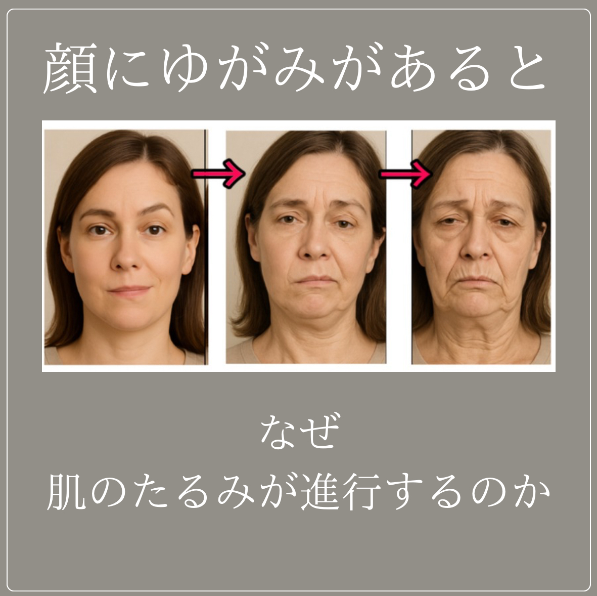 顔にゆがみがあると《確実にお肌たるみます》