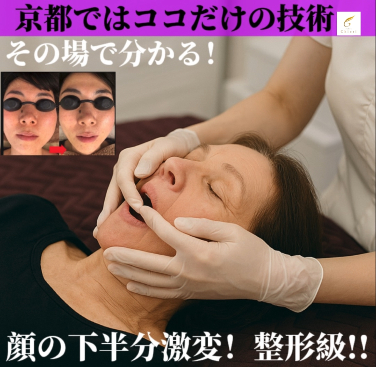 【コレが‼️】たるみ改善×顔のゆがみ矯正の実力