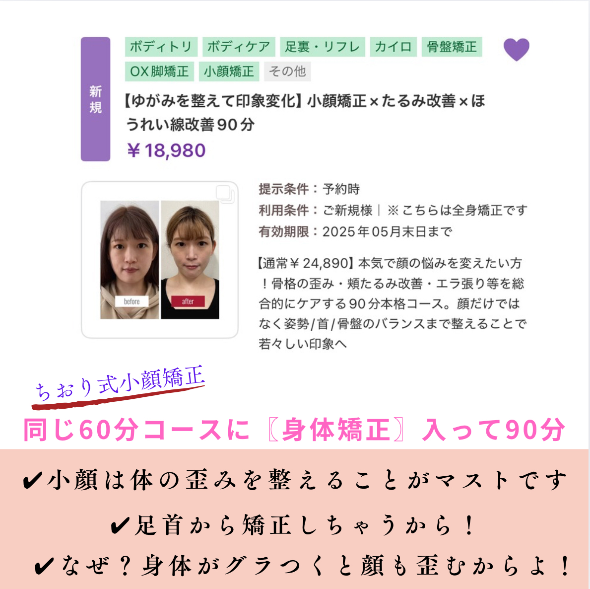 【大人の女性の小顔矯正】結果が見える人気No. 1矯正