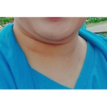 夏前に間に合う！小顔×首肩スッキリ術