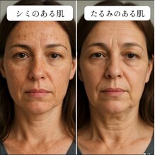 40代女性シミ肌とたるみ肌どちらが老けて見えてるか?!