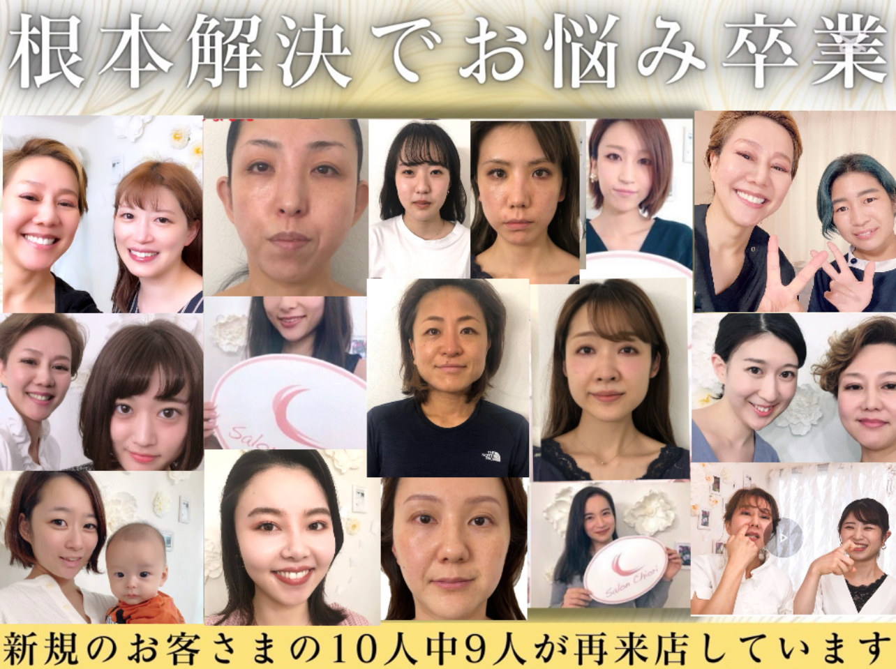 40代からの顔悩みに！！小顔矯正xゆがみ改善で若見え