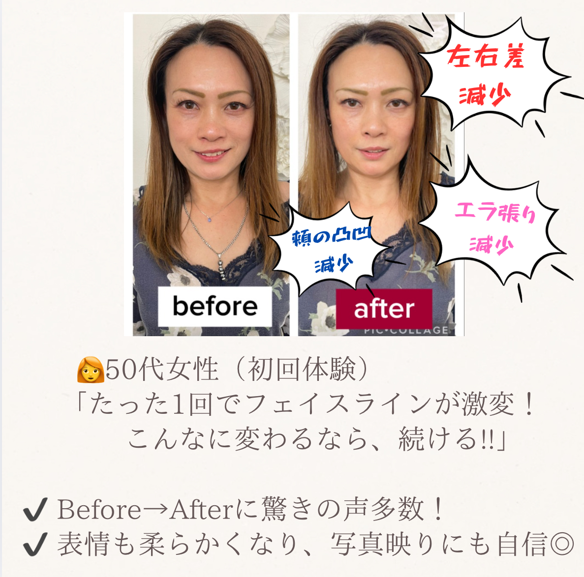 『小顔だけじゃない』美しく整った輪郭になるんです