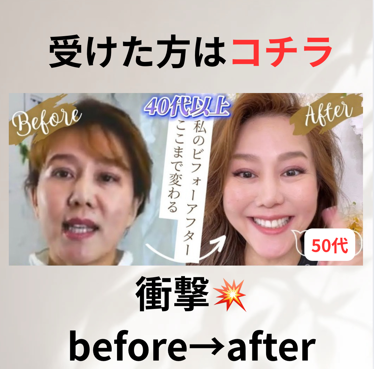 この施術を受けた方の衝撃before→afterをどうぞ
