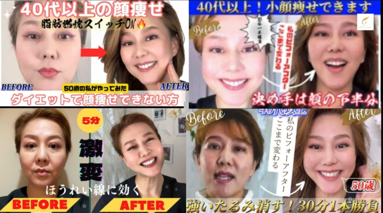 今、大人女性に大人気の小顔矯正‼️