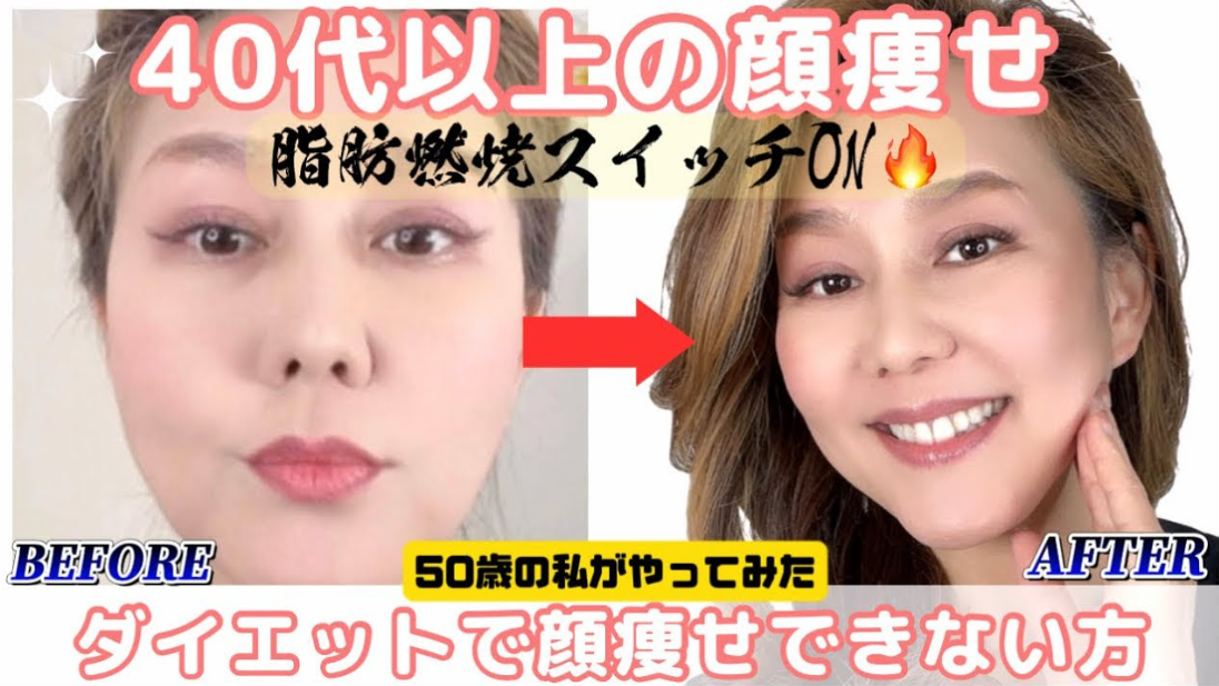 【顔痩せの季節】夏こそ小顔矯正が必要な理由