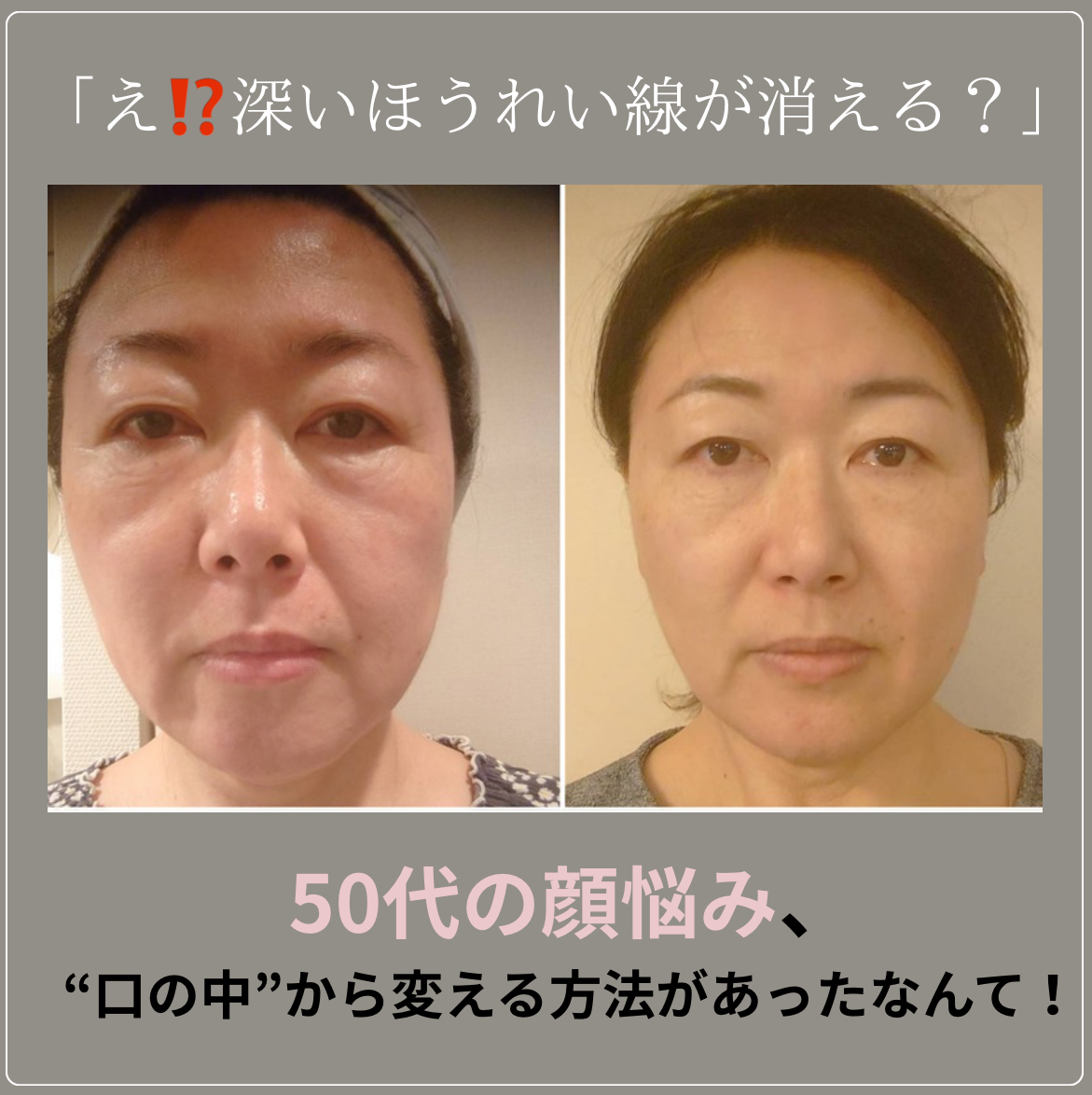 40代以上大人女性の深いほうれい線を改善