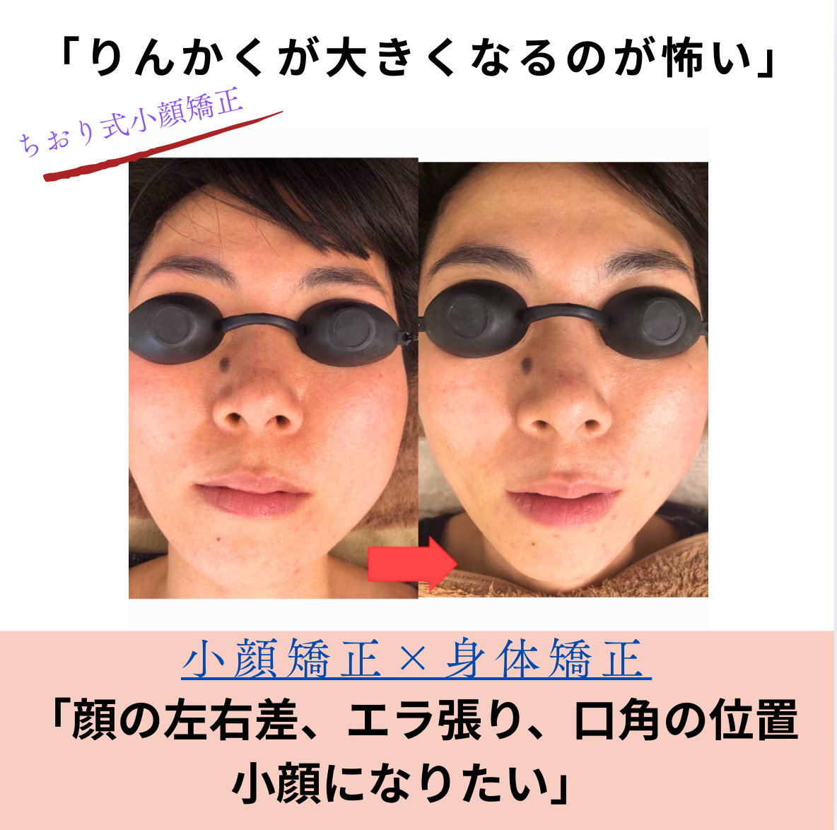 整形せず顔が変わるって本当？