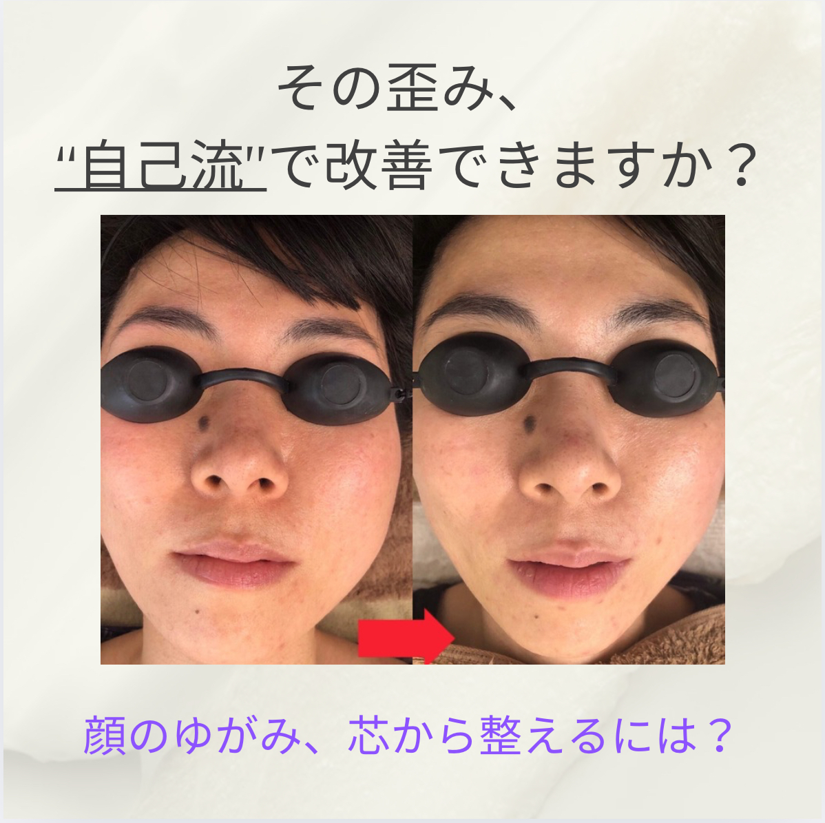 顔のゆがみ改善はプロの技術で