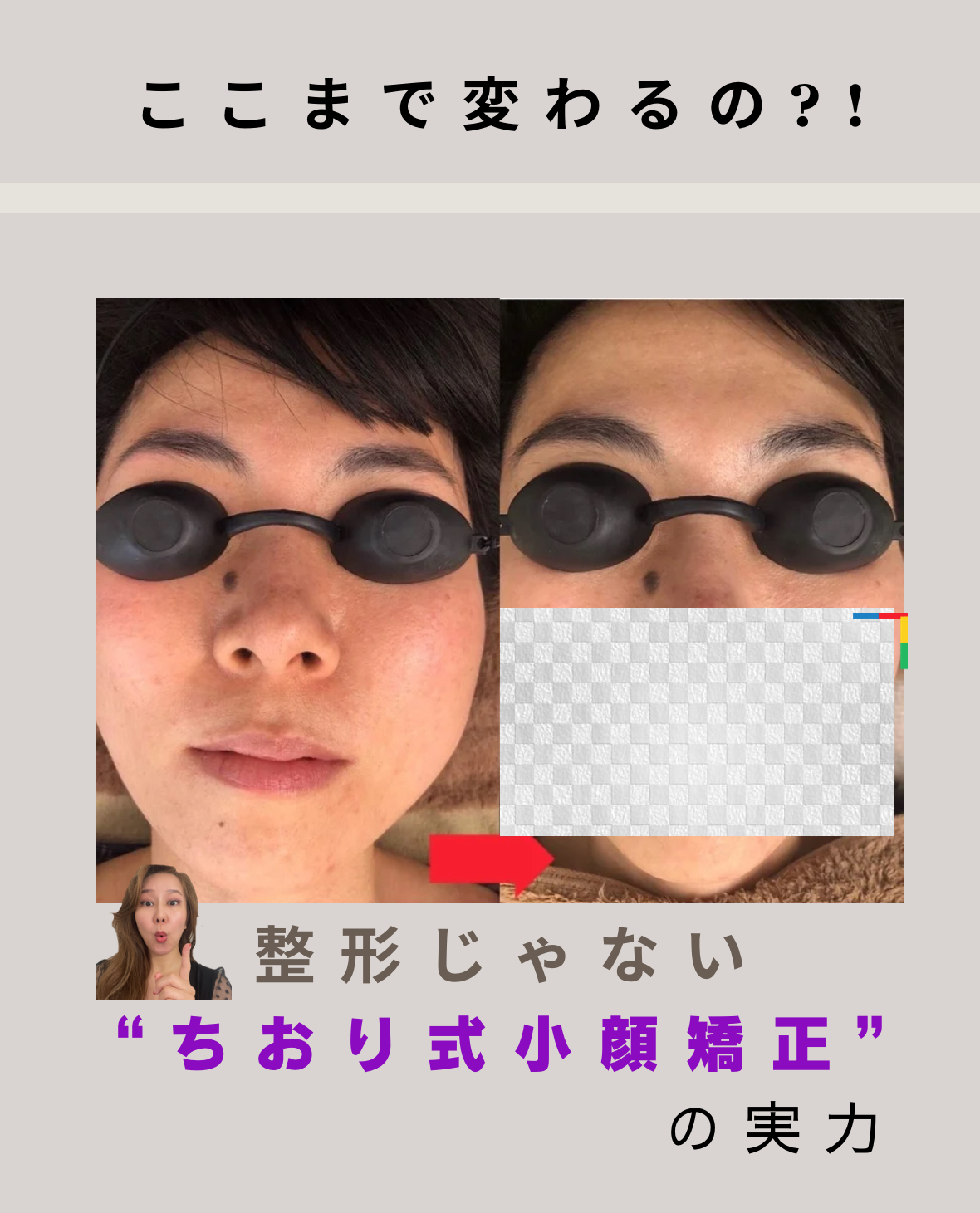 整形なしで顔も心も変わる理由