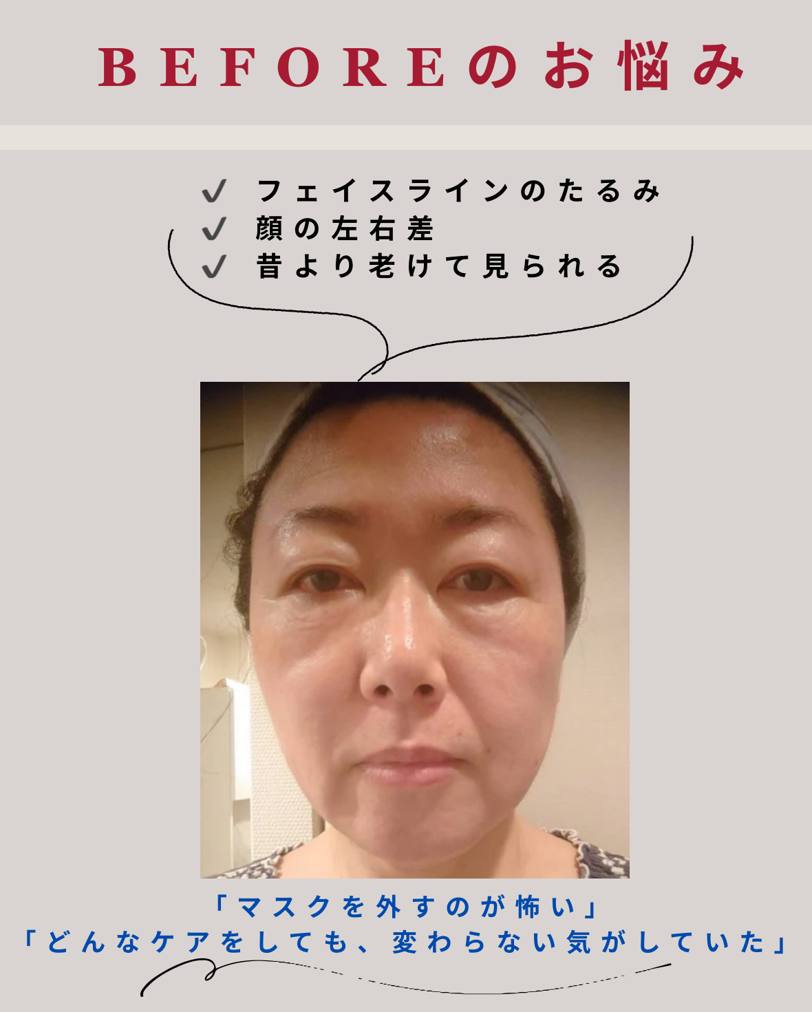 顔の間延び…放置はNGです！