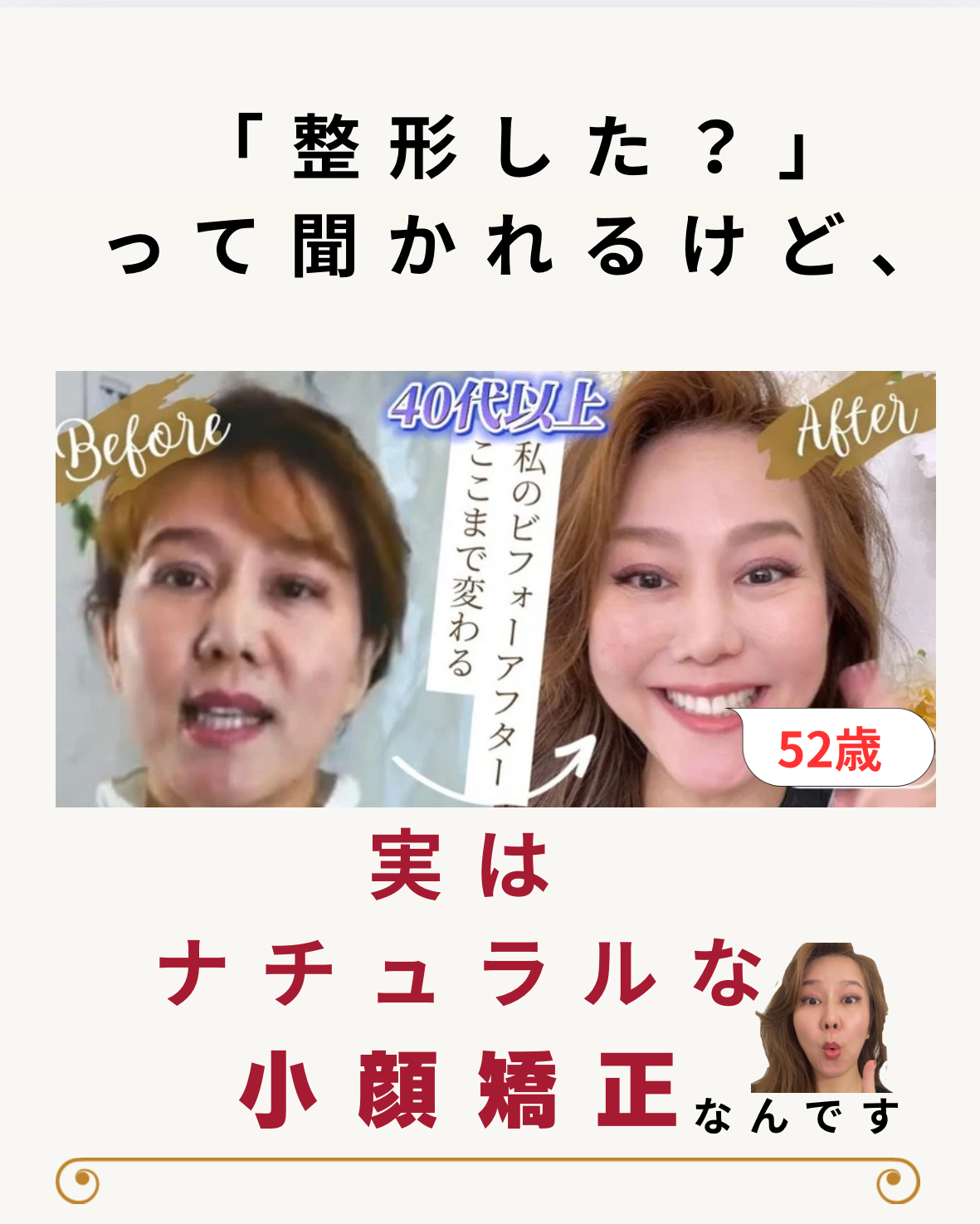 整形じゃないのに変わる理由