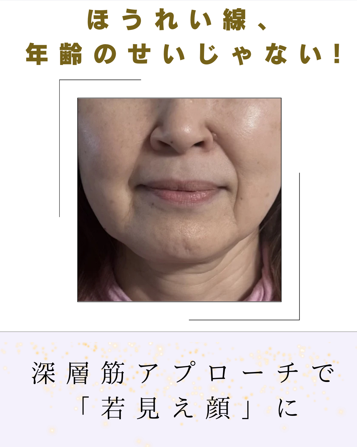 京都烏丸でほうれい線ケア｜口内施術の秘密