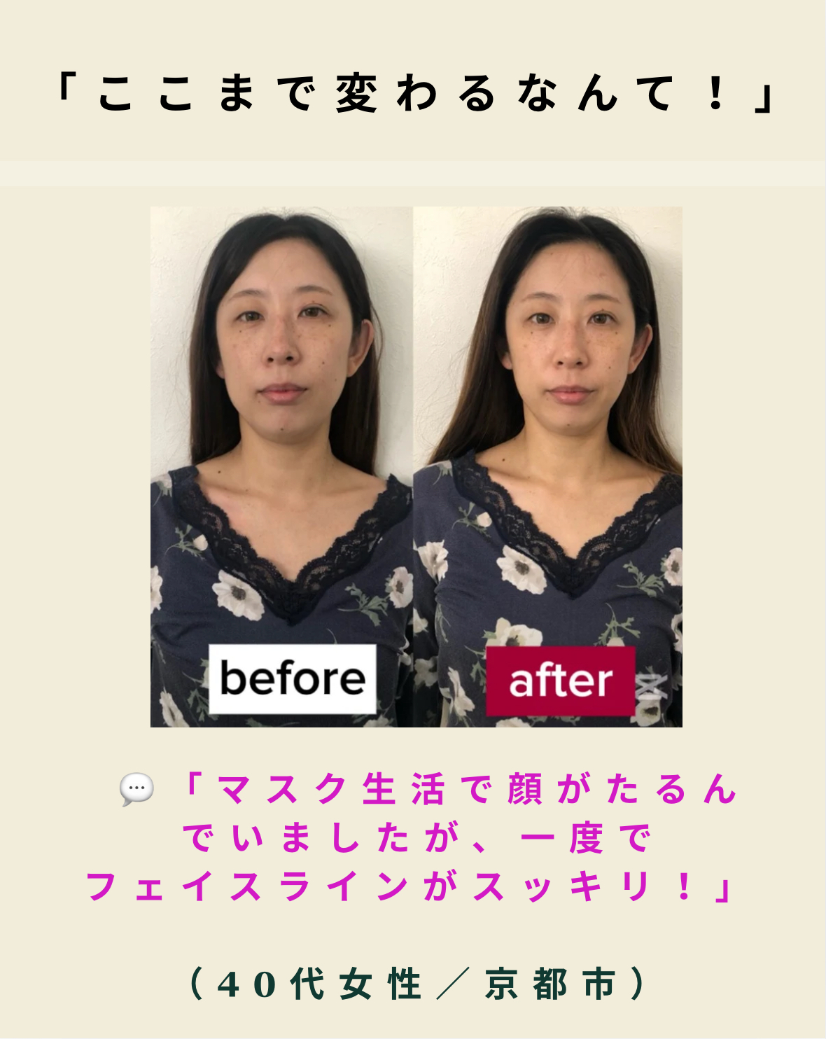 乾燥肌とたるみの関係｜秋のフェイスライン対策