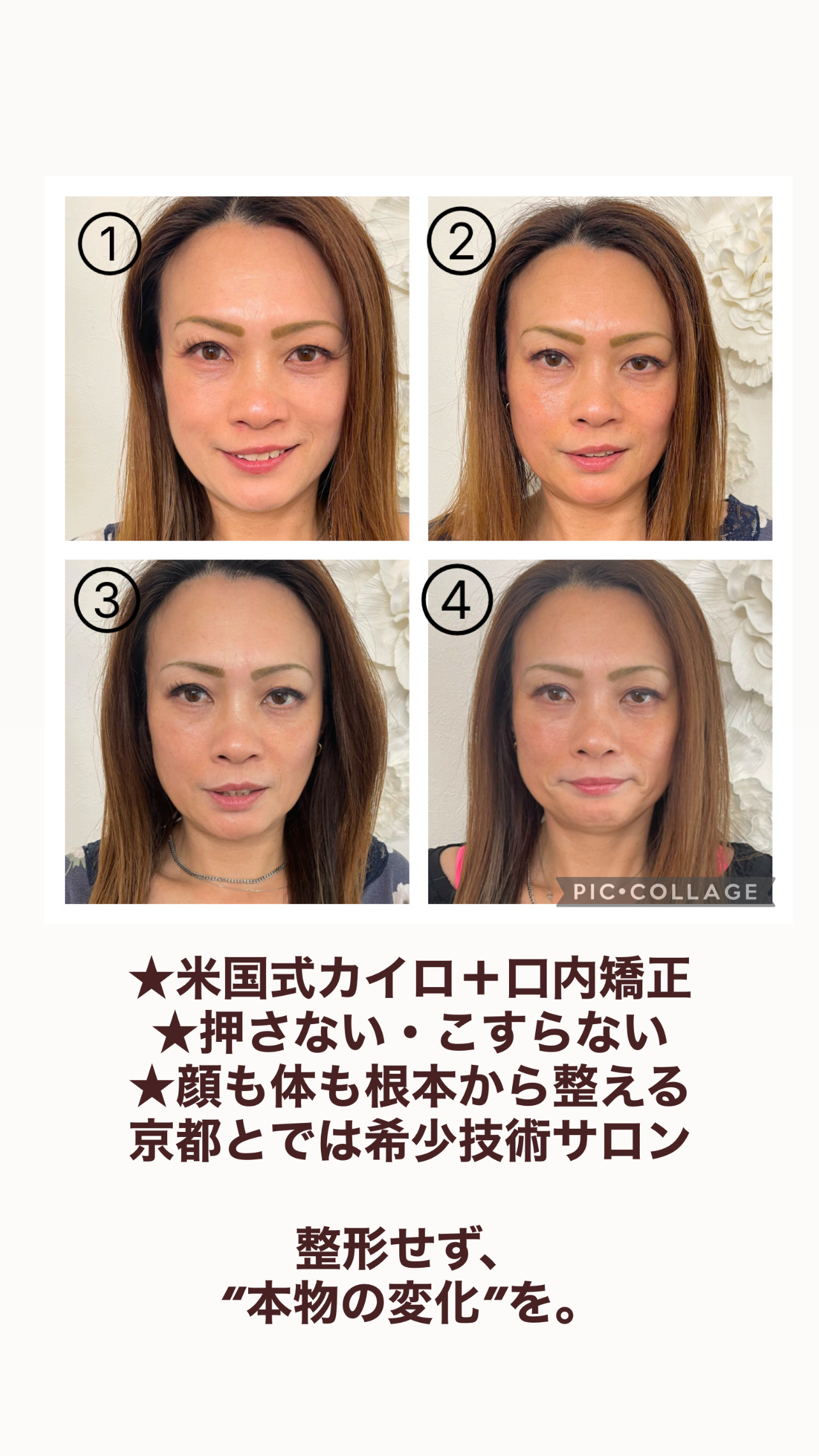 口内アプローチ小顔矯正の真実