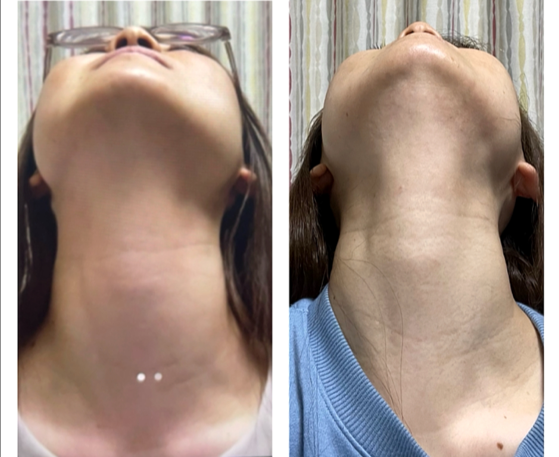 「セルフケア×施術」でここまで変わる！東京から通ってくださったお客様の事例