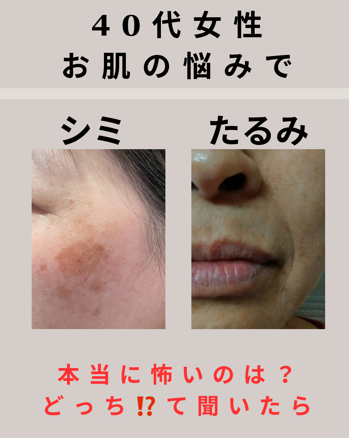 40代女性に多い顔の変化と対策