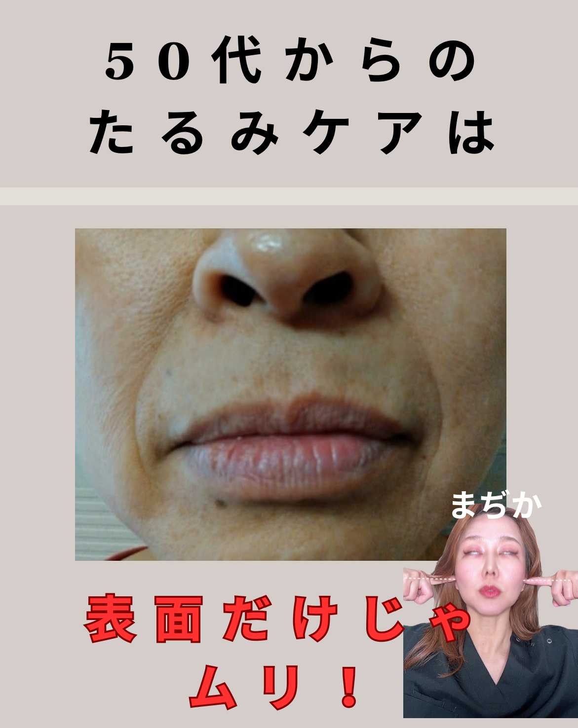 40代女性に急増！顔の左右差とたるみ