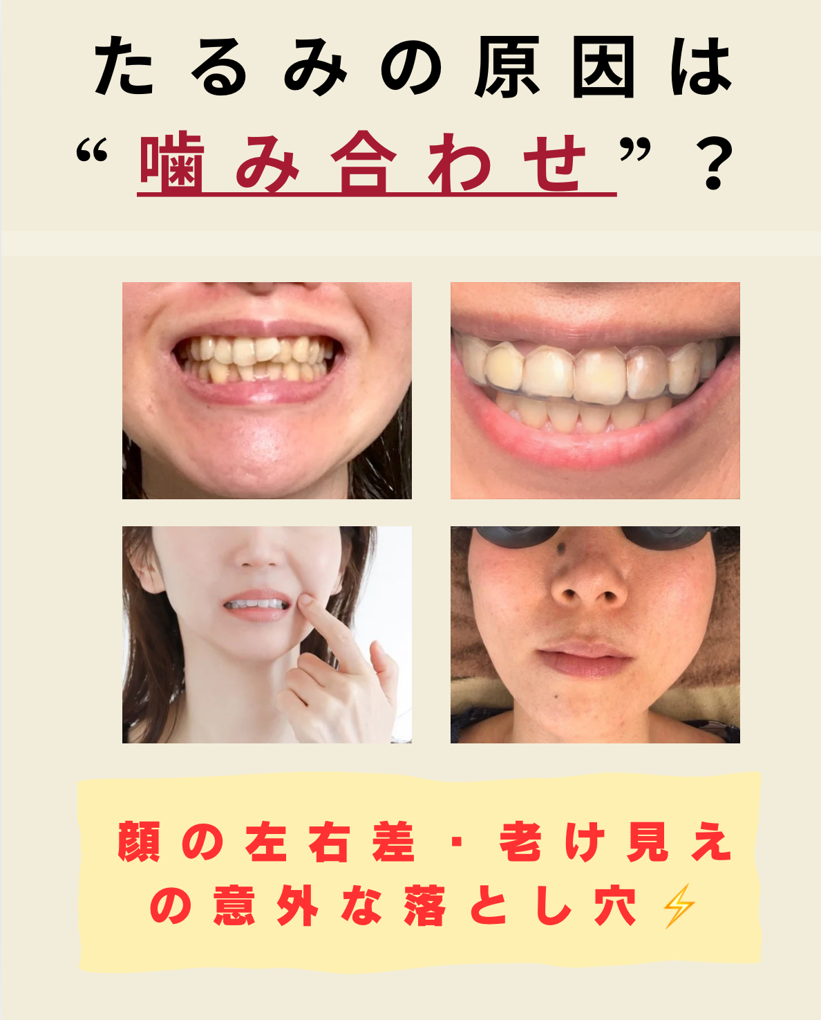 「歯の噛み合わせと顔のたるみ改善」