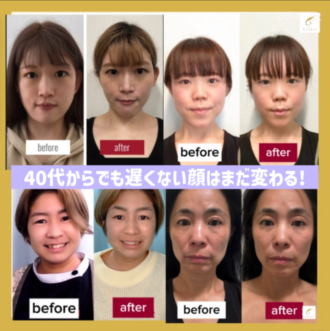 40代女性専用｜サロン級おうちセルフケア