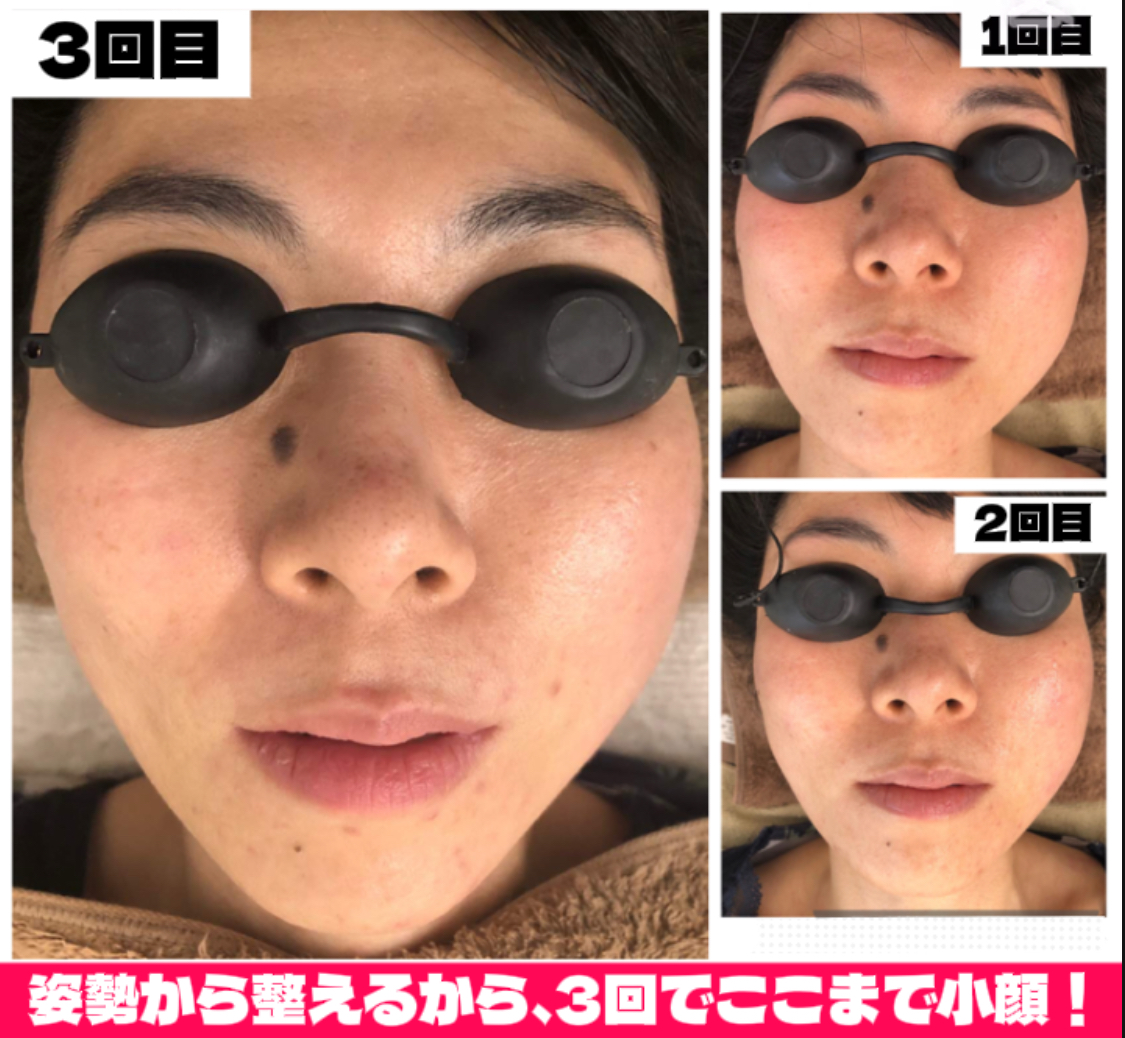 たるみ改善の近道は“通う技術”にあり