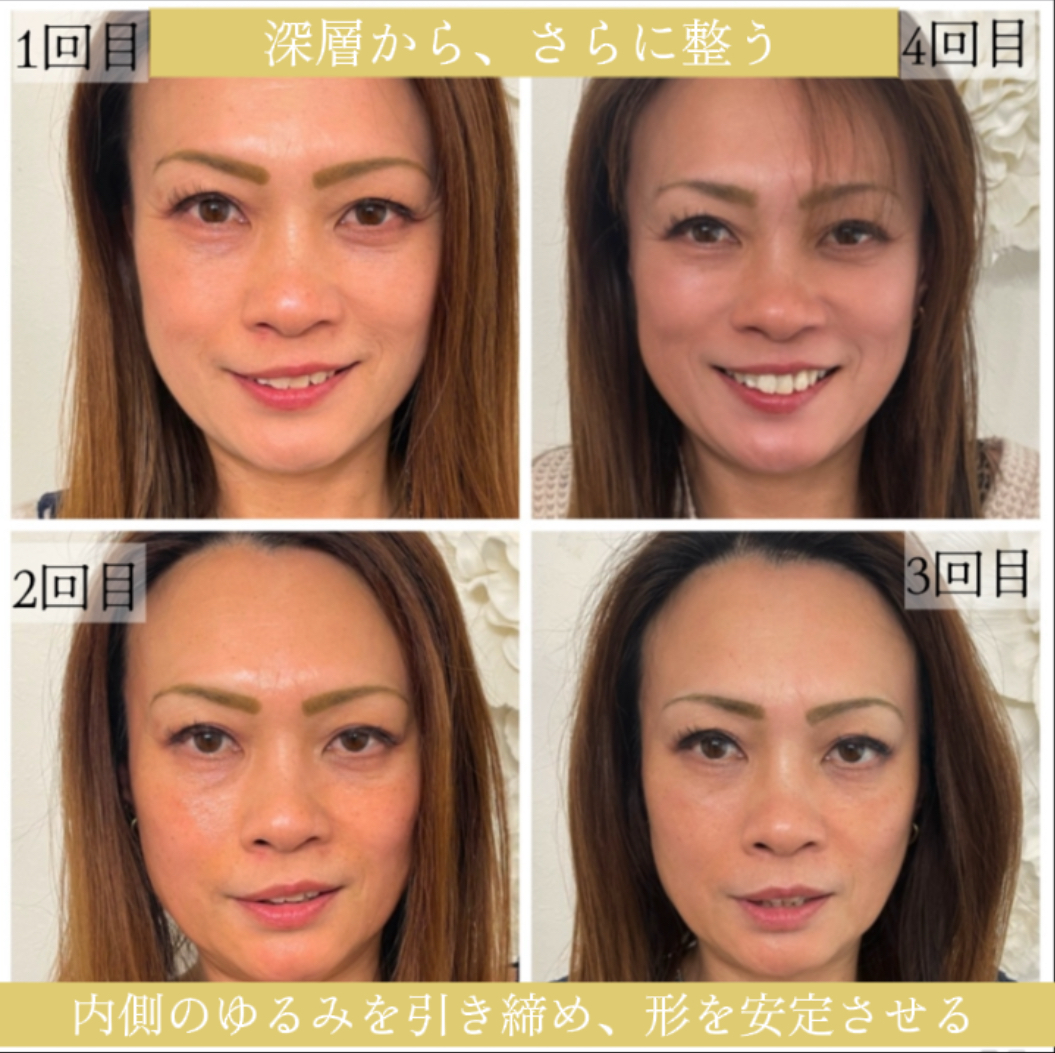 【5回完成★ほうれい線撃退60分】猫背改善で10歳若見え！本格プログラム¥ 59,800