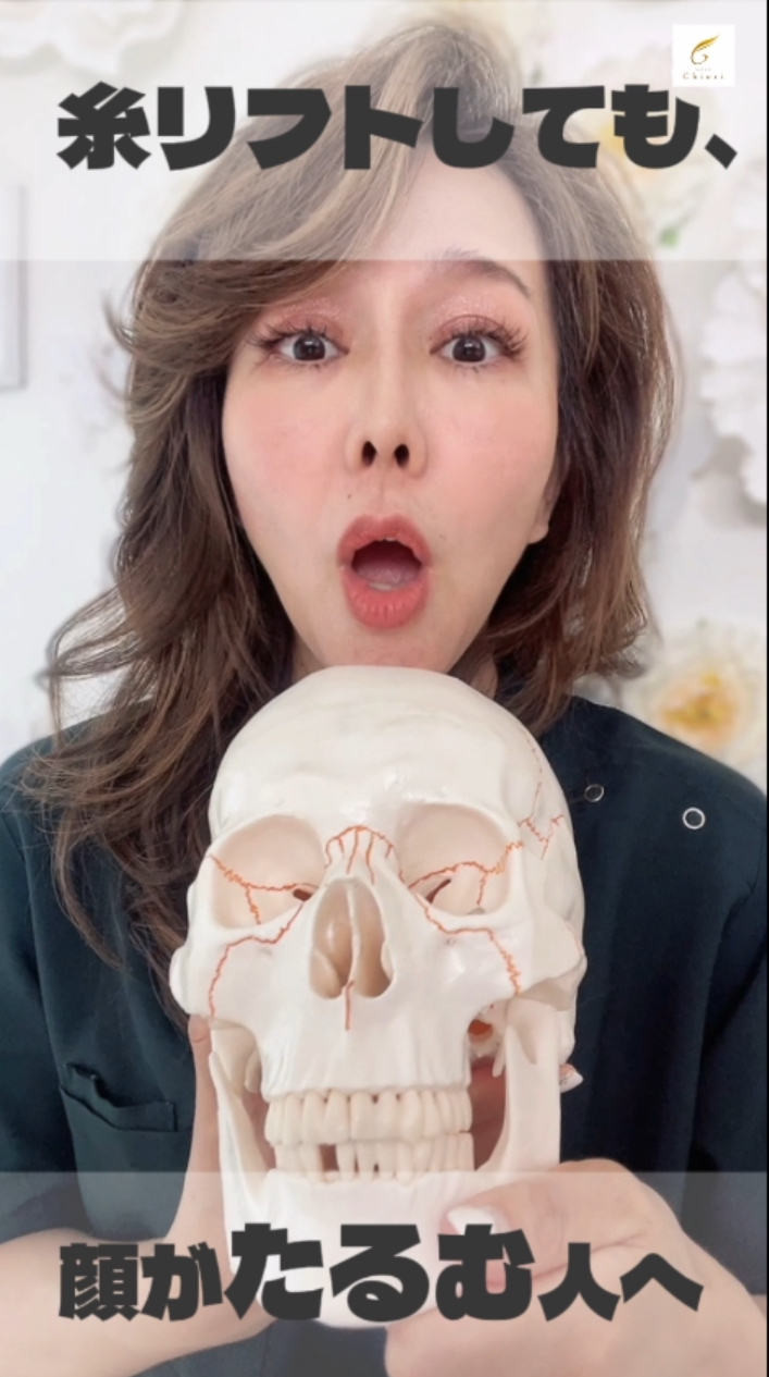 糸リフトしても、顔がたるむ人へ