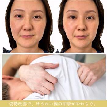 40代からのほうれい線「体から消す方法」ご存知ですか